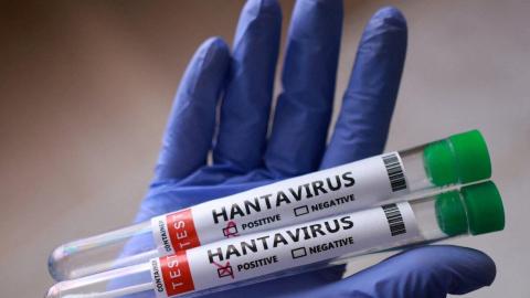 Hantavirus has no cure. Here's where researchers are at with treatments and vaccines