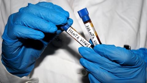 Hantavirus outbreak could be over 'sooner rather than later': Infectious diseases specialist