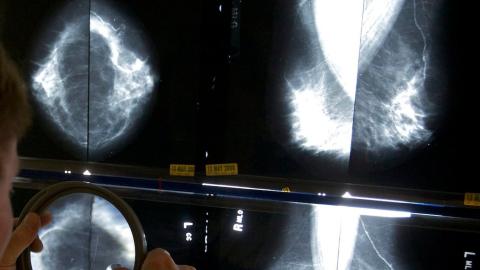 Health Canada approves drug that treats hot flashes for use by breast cancer patients