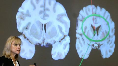 Hidden genetic damage is part of CTE