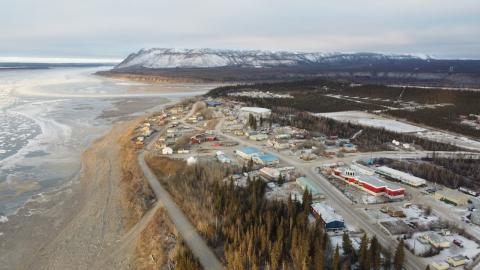 How the Northwest Territories became a dentistry desert
