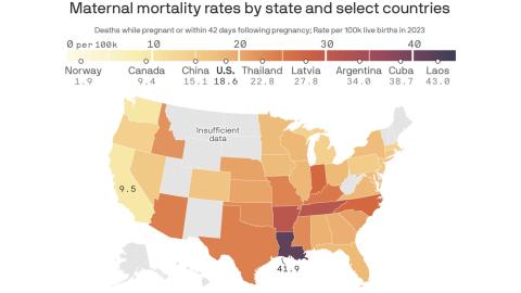 How U.S. states' maternal mortality compares to other countries