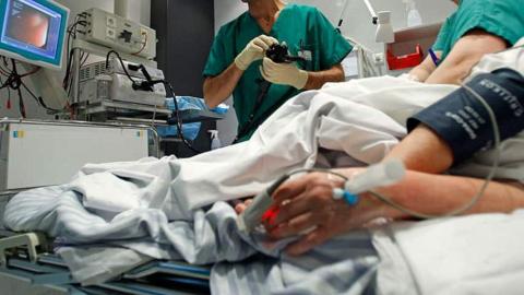 I almost skipped my colon cancer screening, but my bottom and I survived the scope
