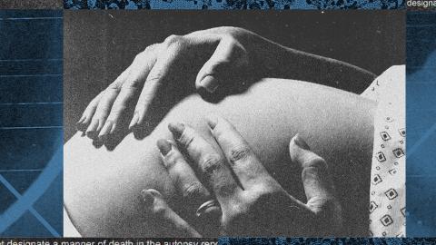 In U.S. Courts, an Unvalidated 'Lung Float Test' Is Still Used to Justify Murder Charges After Pregnancy Loss