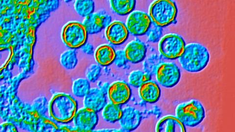 Is hantavirus the next COVID? Is the U.S. response on point? An outbreak update