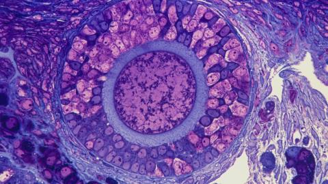 It's Time to Give the Ovary Some More Respect