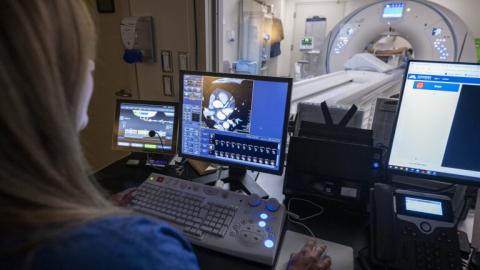 Kingston Health Sciences becomes first hospital in Canada to acquire AI tool to diagnose coronary artery disease