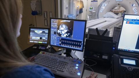 Kingston hospital first in Canada to adopt AI tool for heart disease diagnosis
