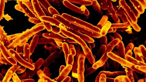 Long a dream, it's now real: a fast and accurate TB test that doesn't need phlegm