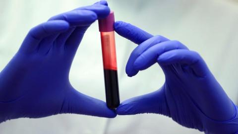 Made-in-B.C. test determines which parent passed on gene linked to increased cancer risk