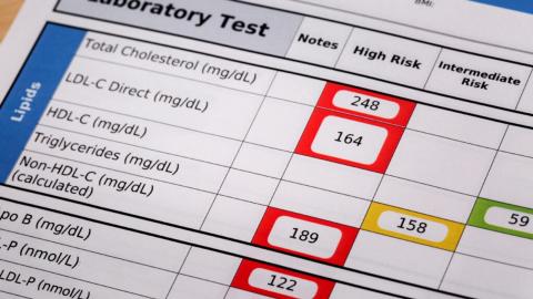 Major changes to cardiovascular guidelines suggest taking statins as young as 30