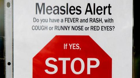Measles exposure alert issued for Foothills, Alberta Children's Hospital emergency departments