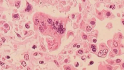 Measles exposure at Winnipeg Jets game, province warns large events may pose risk for months