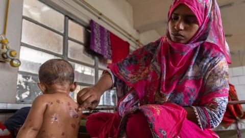 Measles outbreak kills at least 15 in Bangladesh