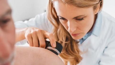 Melanoma skin cancer cases in UK hit record level, analysis finds