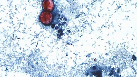 Michigan reports first U.S. deaths from multi-state cyclosporiasis outbreak