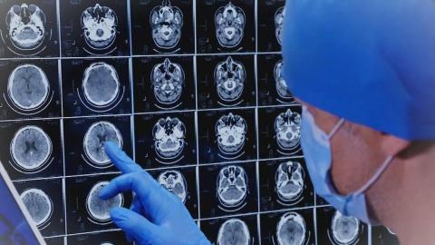 New Brunswick, feds to provide more than $4 million in Alzheimer's care training