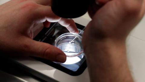 New IVF technique reduces risk of inheriting genetic diseases