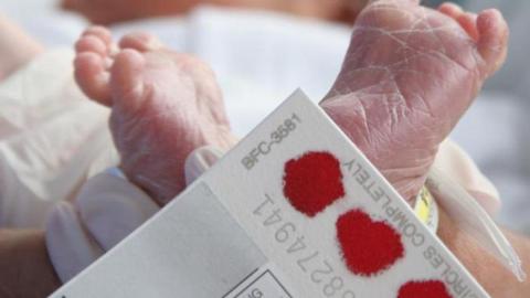 Newborns protected from E coli infections by microbes from mom, study suggests