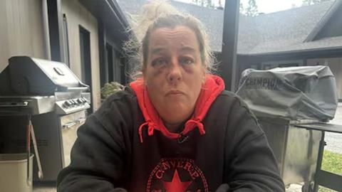Nurse beaten in psychiatric ward of hospital in Quebec City calls for more safety measures