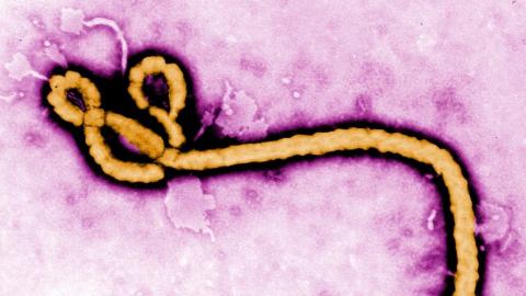 One person with recent travel to East Africa being tested for Ebola virus in Ontario