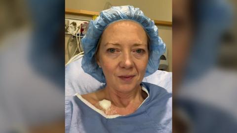 Ontario is about to reduce colon cancer screening age limit. Other provinces should follow, urge advocates