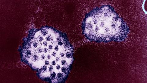 Ontario public health unit warns of infectious stomach illness uptick