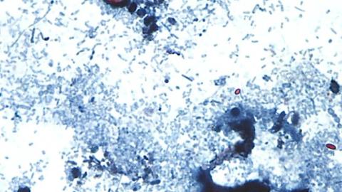 Outbreak of diarrhea-causing parasite grows to more than 1,000 cases