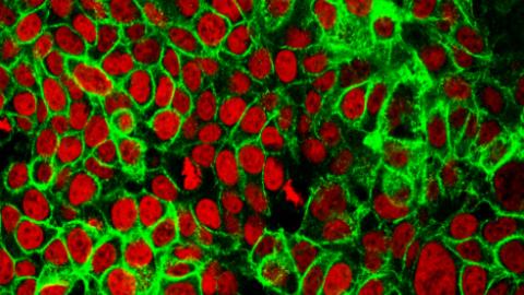 Preparing for a looming cancer crisis
