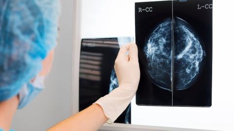 Province expanding free breast cancer screening to Albertans 40 and over