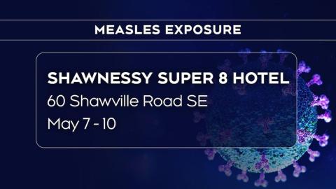 Public alert for measles exposure in Calgary issued by province