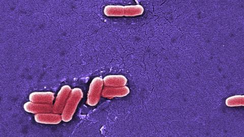 Raw dairy co. refutes connection to US E. coli outbreak