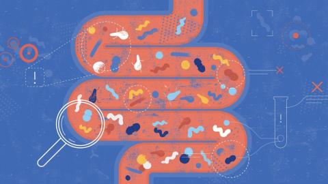 Scientists search the microbiome for clues to the rise in colorectal cancers