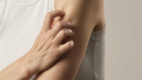 Shingles can hit younger than you think. The vaccine can prevent excruciating pain