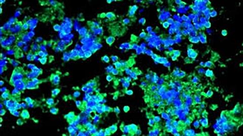 Some Immune Systems Defeat Cancer. Could That Become a Drug?