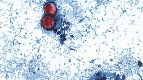 Source of U.S. diarrhea-causing outbreak back in question after FDA declares false positive