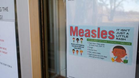 South Carolina measles outbreak surpasses Texas' 2025 reported total, with little sign of slowing