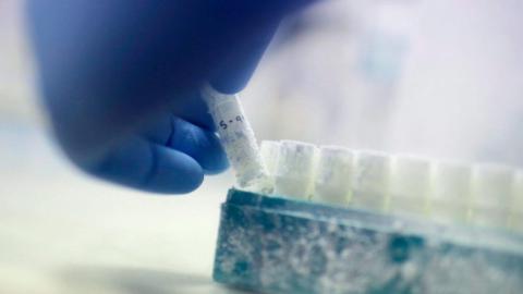 Sperm cells are at their highest quality during summer, study finds