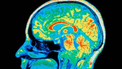 Supposedly distinct psychiatric conditions may have same root causes