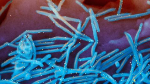 ‘The kids of Alberta deserve it’: Pediatricians seek universal coverage for RSV shots