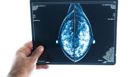 These are the Canadian regions with the highest rates of breast cancer