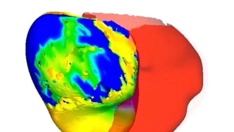 To fix a patient's irregular heartbeat, doctors first tested its digital 'twin'