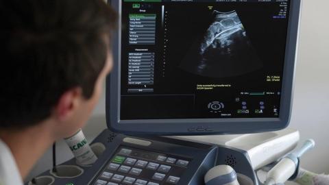 Toronto researchers use AI to tackle endometriosis diagnostic delays