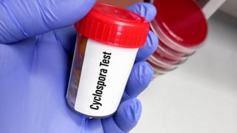 Trump's deep public health cuts hinder response to record US cyclosporiasis outbreak