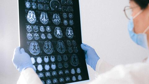 U.K. aims to transform Alzheimer's diagnosis with blood test trial