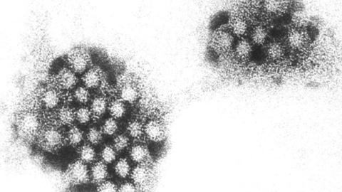 “Ultra-premium cruise” beset by norovirus outbreak