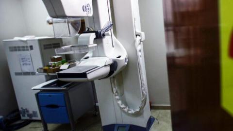 US' new Medicaid restrictions will likely reduce cancer screenings