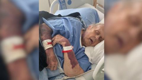 Watchdog calls on Toronto hospital to remove ‘militaristic’ language from security policies after elderly patient injured