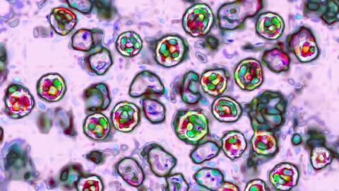 What to know about the surging South Carolina measles outbreak and quarantines