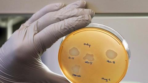 WHO ramps up efforts against drug-resistant bacteria